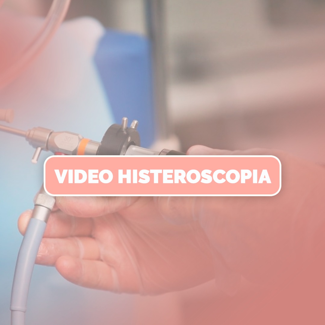 videohisteroscopia-glamis-amazonas-ginecologista-campinas-sp