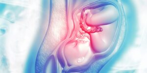 malformacoes-uterinas-clinica-cirurgica-dra-glamis-amazonas-ginecologista-campinas-sp